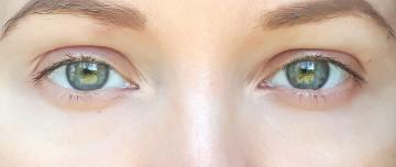 Blaue Flecken unter den Augen: wie zu vertuschen und nicht Stress Alter